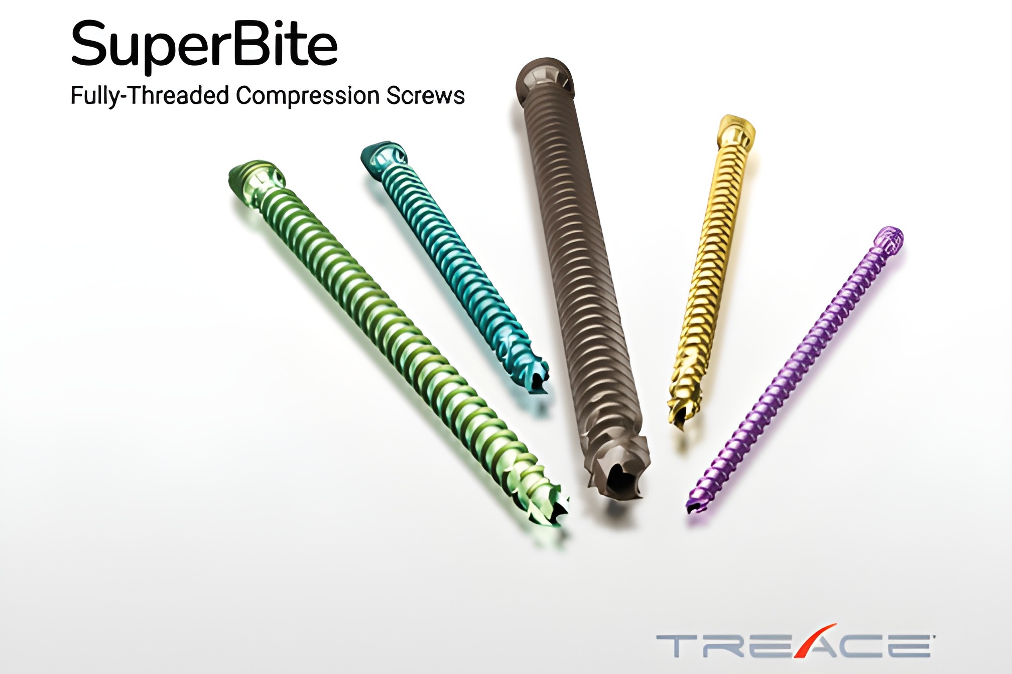 Treace_Launches_SuperBite_Compression_Screw_System_9495_0.jpg